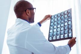 România s-ar putea confrunta cu un val de persoane diagnosticate cu cancer în stadii avansate, cred medicii