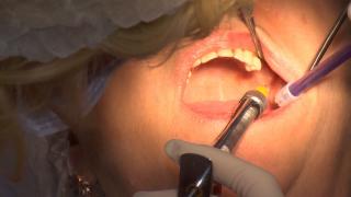 Falşii stomatologi care ar fi mutilat sute de persoane, plasaţi sub control judiciar. Explicația anchetatorilor