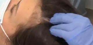 Căderea părului: cauze şi tratament. Care sunt primele semne la care ar trebui să fim atenţi