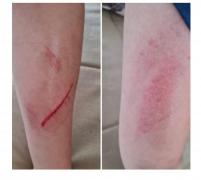 Băiat, umilit şi rănit de colegi într-o şcoală din Târgu Jiu. Profesorii au aflat de incident de pe Facebook