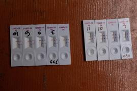 Medicii ameninţă cu blocarea activităţii în spitale, dacă sunt obligaţi să se testeze de coronavirus pe banii lor