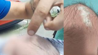 Medic, acuzat că a tăiat pe cap copilul în timpul operaţiei de cezariană. Părinţii se tem că i-ar putea pune viaţa în pericol mai târziu