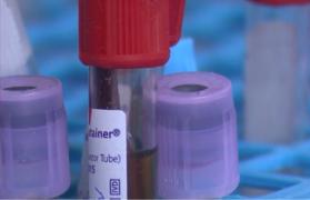 A explodat numărul de cazuri de enterocolită în România. Recomandările medicilor