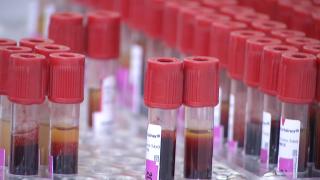 Camera ascunsă. Analizele pentru persoanele de peste 40 ani ar trebui să fie gratuite, dar patru clinici au refuzat să le facă