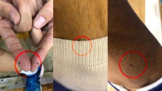 Antrenamente cu purici la Sala Sporturilor din Piteşti. Sătui să ajungă acasă plini de ciupituri, sportivii protestează. "Sună amuzant, dar este periculos"