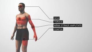 Cum s-a nenorocit pe viață tânărul de 19 ani din Iași care a găurit o bombă cu bormașina. A încercat să-i mintă pe medici