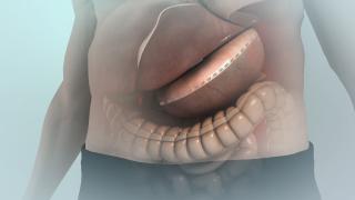 Animaţie grafică. Campionul de raliu Daniel Onoriu este la terapie intensivă după ce şi-a tăiat stomacul în Turcia: "S-a desprins o capsă"