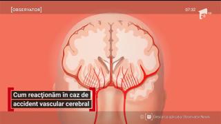 Cum reacţionăm în caz de accident vascular cerebral