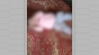 O fetiţă de un an şi jumătate din Bacău, lovită cu sălbăticie de propria mamă. Femeia se răzbuna astfel pe fostul soţ plecat la muncă în străinătate