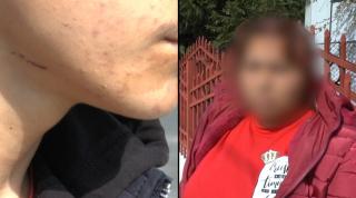 Elev din Neamț, snopit în bătaie de un angajat al școlii, după ce s-a îndrăgostit de fiica lui: "A fugit să ia o rangă de fier să-i dea în cap"