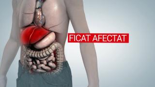 Care sunt simptomele noii hepatite severe, cu cauză necunoscută. Primul caz din România, o fetiţă de 5 ani