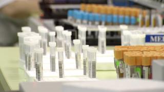 Analiza foarte importantă de care puțini români știu că este gratuită. Majoritatea plătesc sute de lei pentru ea, la privat