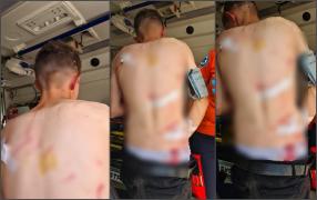 Un tânăr de 19 ani din Harghita, atacat de urs în fața familiei sale. Oamenii au alungat animalul cu tractorul