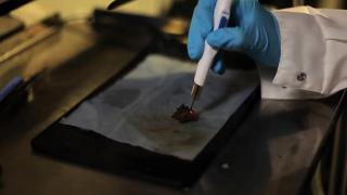 Descoperire revoluţionară a cercetătorilor britanici. Cancerul uterin, diagnosticat în câteva secunde