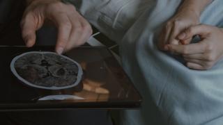 Depresia, tratată cu ajutorul unui cip implantat în craniu. Cum funcţionează dispozitivul creat de cercetătorii americani