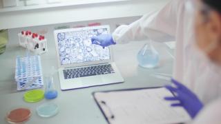 Un nou test de sânge poate detecta 25 de tipuri de cancer, înainte cu un an ca tumoarea să se formeze