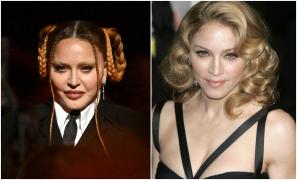 Madonna regretă operaţiile estetice făcute. Cum a reacţionat după valul de critici în urma apariţiei la premiile Grammy