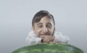 Un tânăr de 20 de ani a intrat în Cartea Recordurilor pentru cele mai scurte mâini din lume