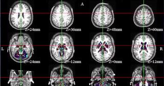 Bucharest Tech Week 2023. Terapia unică în Europa ce poate oferi soluţii chiar şi în cazul afecţiunilor pentru care nu există încă un tratament