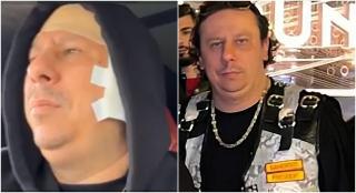 Dragoș Furtună, patronul împuşcat şi bătut de motocicliştii Hells Angels, amenință după externare: "Au fost niște proști care o să plătească"