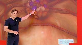 Care sunt primele simptome ale diabetului. Unul din zece oameni suferă de această boală