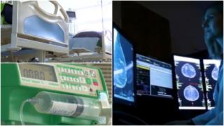 Un medicament pentru prevenţia cancerului de sân aprobat în UK există și în farmaciile din România. Este prescris doar pentru persoanele diagnosticate cu boala