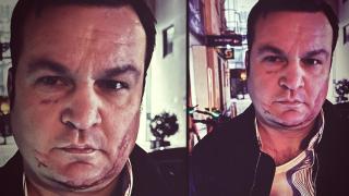 Cătălin Cherecheș nu vrea să se întoarcă în România. Cât ar putea dura extrădarea fostului primar