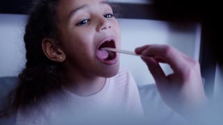 Ce este amigdalita. Cauze, simptome şi tratament