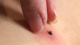 Ce trebuie să faceţi dacă vă treziţi cu o căpuşă pe piele. Nu trebuie să o scoateţi forţat