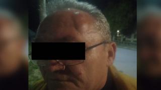 "M-a luat la bătaie că nu votez cu el”. Paznicul unei primării din Mehedinți, bătut de edilul localității, nervos că nu-l votează la alegerile locale