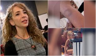 "Doar v-a stropit, atât". Mărturia părinților copilului mușcat de o femeie. Agresoarea a fugit după el pe plajă și l-a și zgâriat