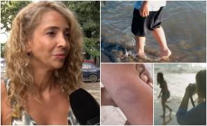 "Am căzut peste copil. Degetul, unghiile l-au zgâriat". Cum se apără femeia acuzată că a mușcat un băiețel de 6 ani, pe o plajă din Năvodari