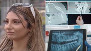 Ce a pățit Larisa după ce a mers de urgență la un cabinet stomatologic găsit într-un bloc din Berceni: "Nu puteam să îmi deschid gura"