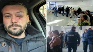 Bătaie în ziua alegerilor prezidenţiale în Slatina. Director de pază, cu ochiul învineţit