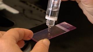 Sperma donată unei clinici de fertilizare din Olanda, folosită ilegal pentru zeci de inseminări