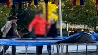 Medic, despre copilul tăiat de paznic cu secera în parc: "Era un nerv acolo, dar nu a ajuns la el"