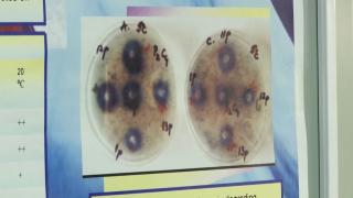 Femeia cu lepră, angajata unui SPA din Cluj, ar fi luat boala din Bali de la mama ei. "Nu se ia prin masaj"