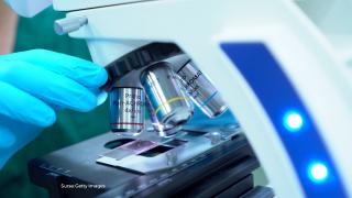 Tratamentul care aduce speranţe lumii întregi: a fost găsit leacul pentru cancerul pancreatic