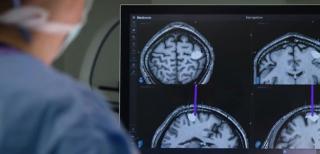 Un cip implantat în creier i-a redat vocea. Povestea unui american care a primit o nouă şansă la viaţă