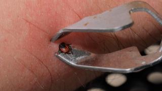 Cum scoţi corect o căpuşă de sub piele şi care sunt primele semne că ar trebui să mergi la medic