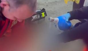 Un chirurg a făcut o operaţie pe cord deschis direct pe stradă. A salvat un bărbat înjunghiat în doar 7 minute