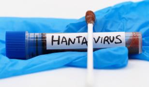 Suspiciune de hantavirus la un pompier din Caraş-Severin. Bărbatul are febră de trei săptămâni