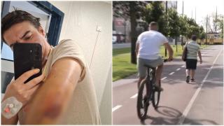 O pistă de biciclete modernizată face victime pe bandă rulantă într-un oraş din România. Reacţia primăriei