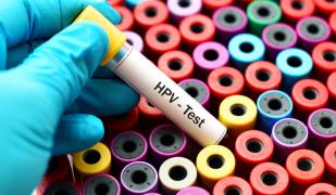 Ce înseamnă un rezultat HPV modificat? Ghid pentru paciente