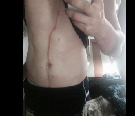 ŞOCANT! Ce au găsit medicii în corpul unui australian i-a îngrozit