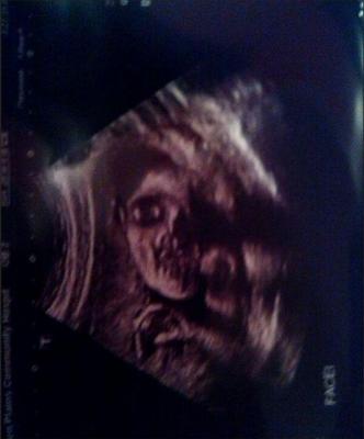 O viitoare mămică a vrut să-şi vadă copilul nenăscut! Ecografia a scos la iveală o imagine ÎNFRICOŞĂTOARE!