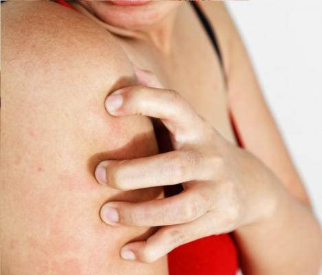 Video! Boala de care suferă îi transformă corpul într-o operă de artă