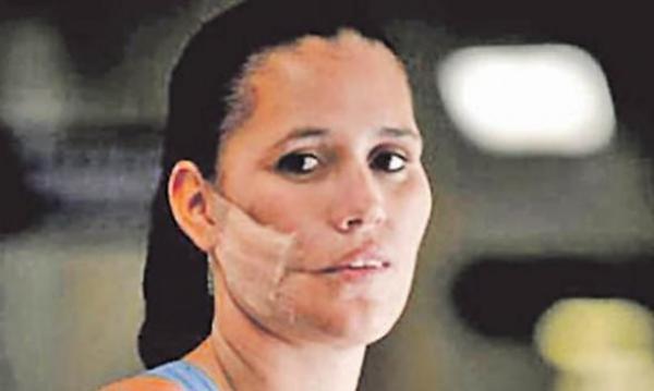 "Simt CEVA acolo!" Nici medicii nu au avut curaj să o atingă! Ce avea femeia în obraz