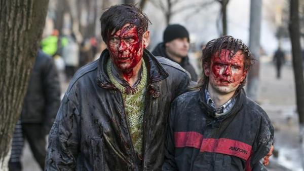 +18! Imaginile groazei în Kiev! Durere, sânge şi spaimă
