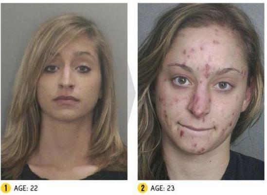 Imagini terifiante! Cum arată aceşti dependenţi de droguri